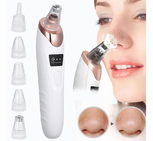 Extractor de Espinillas Multifuncional + Obsequio